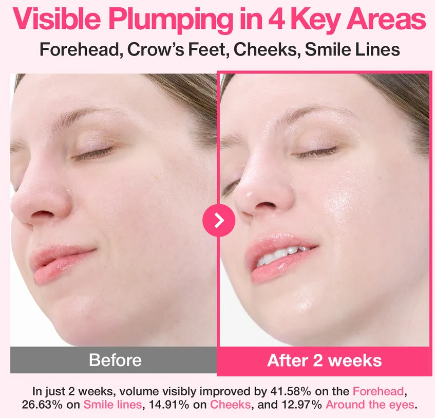 numbuzin rose 2 1.png