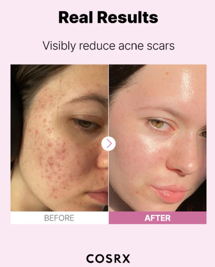 COSRX NIACINAMIDE 15  2.png